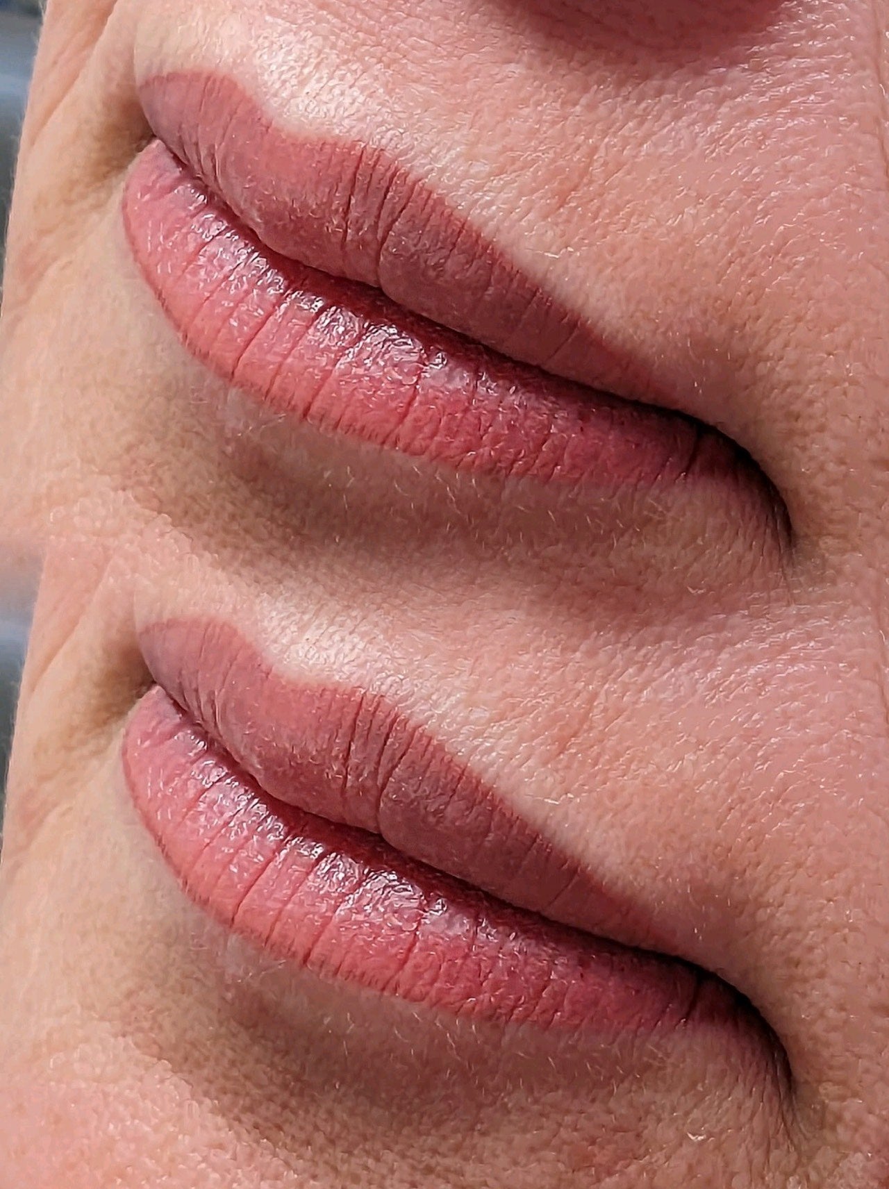 Frozen Lips