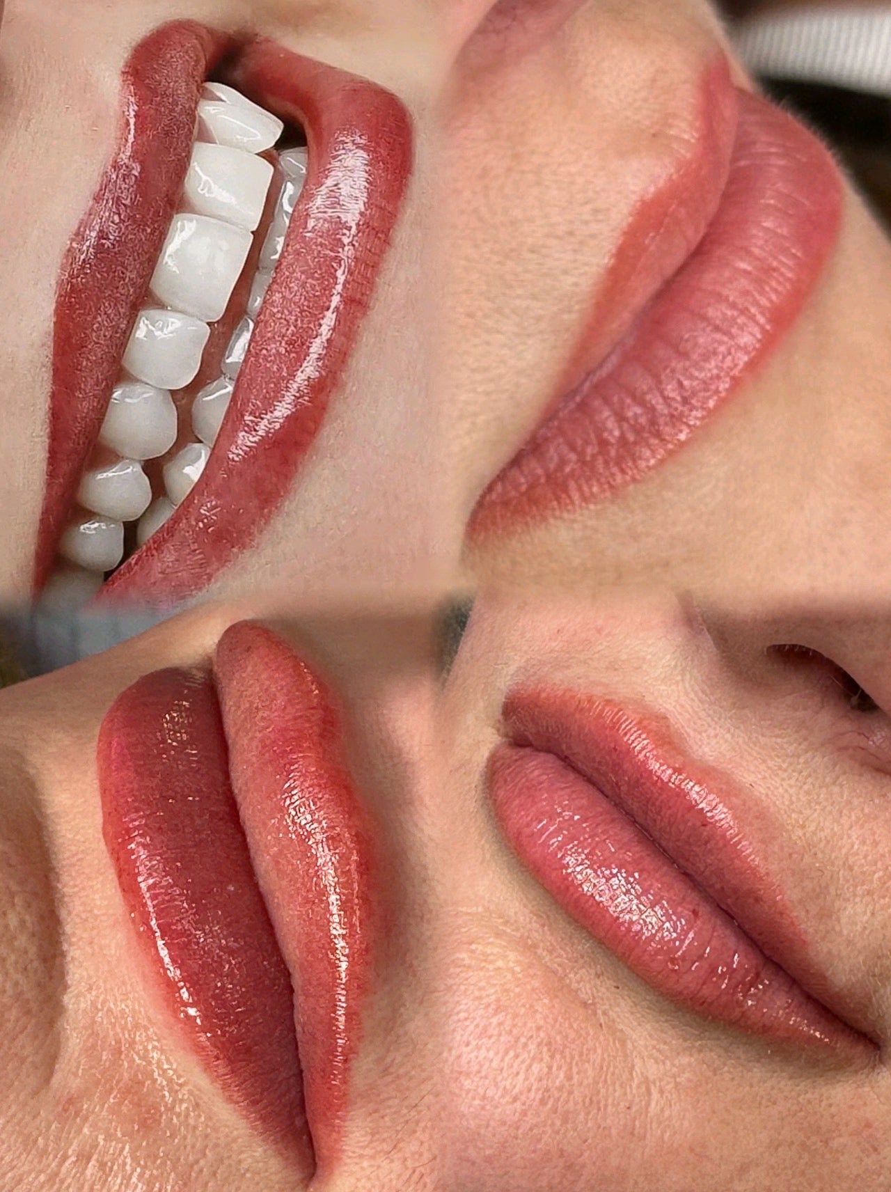 Frozen Lips